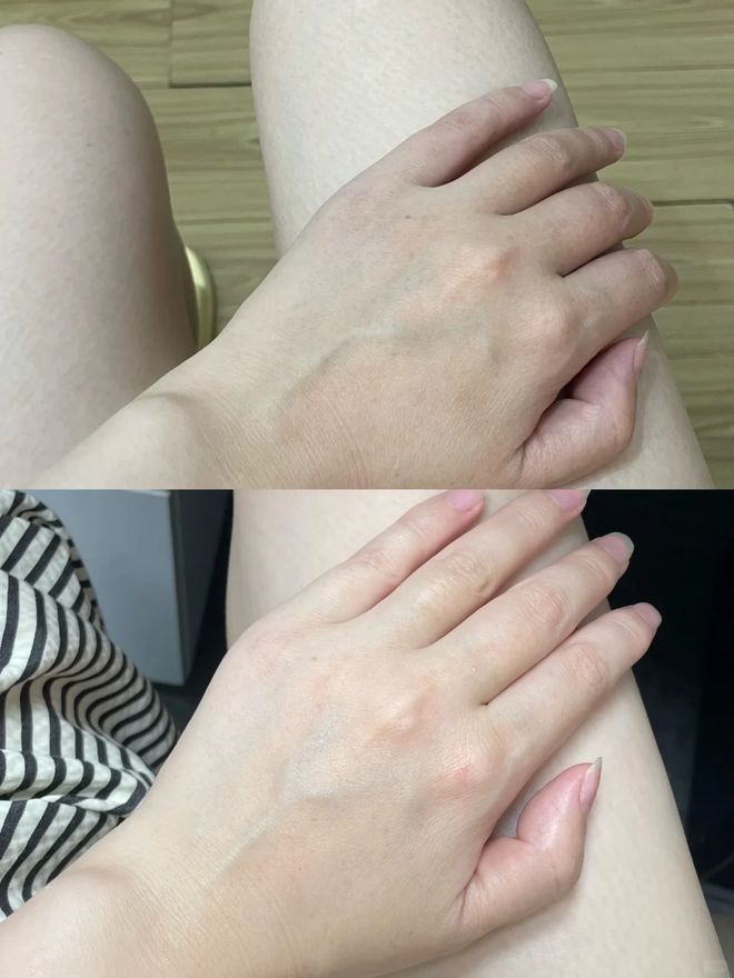 丑!后来发现是小丑竟然是我的手AG真人百家乐一直以为是首饰太(图5) 丑!后来发现是小丑竟然是我的手AG真人百家乐一直以为是首饰太(图5)