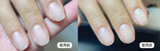丑!后来发现是小丑竟然是我的手AG真人百家乐一直以为是首饰太(图6) 丑!后来发现是小丑竟然是我的手AG真人百家乐一直以为是首饰太(图6)