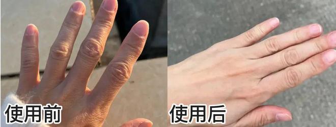 丑!后来发现是小丑竟然是我的手AG真人百家乐一直以为是首饰太(图8) 丑!后来发现是小丑竟然是我的手AG真人百家乐一直以为是首饰太(图8)