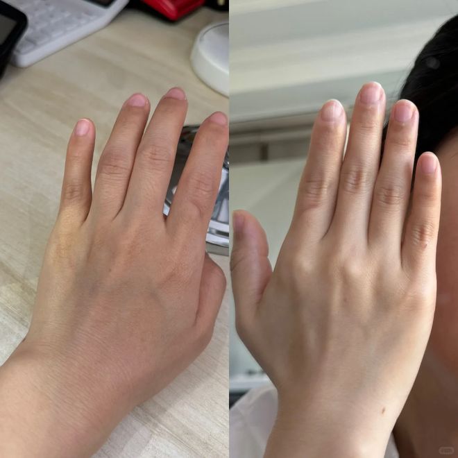 丑!后来发现是小丑竟然是我的手AG真人百家乐一直以为是首饰太(图16) 丑!后来发现是小丑竟然是我的手AG真人百家乐一直以为是首饰太(图16)